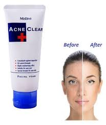 Mistine Acne Clear Facial Foam Face Wash - 85Gm | Made In Thailand